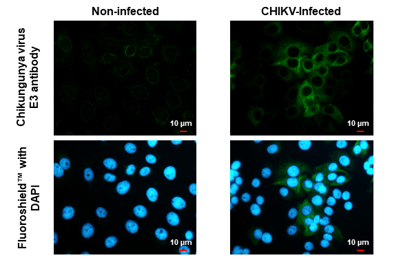 Chikungunya virus E3 antibody